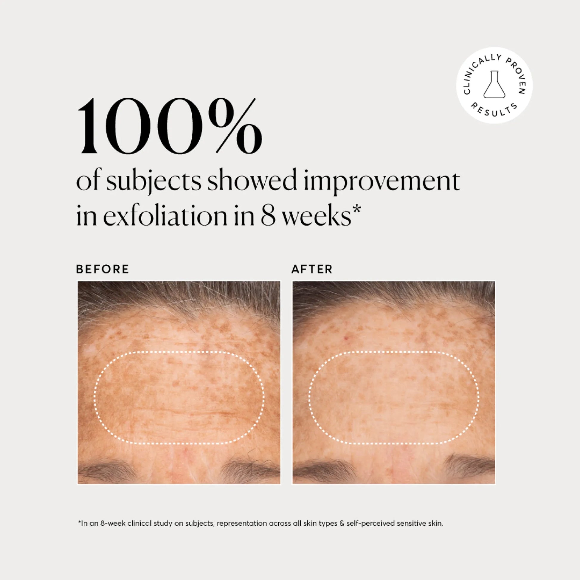 bha-liquid-exfoliant-2-l6 NATR-10027-Alt-Images-BHA-Liquid-Exfoliant-2_-03.webp