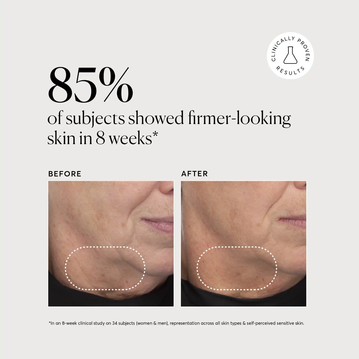 retinol-complex-serum-u0 NATR-10034-Alt-Images-Retinol-Complex-Serum-04.webp